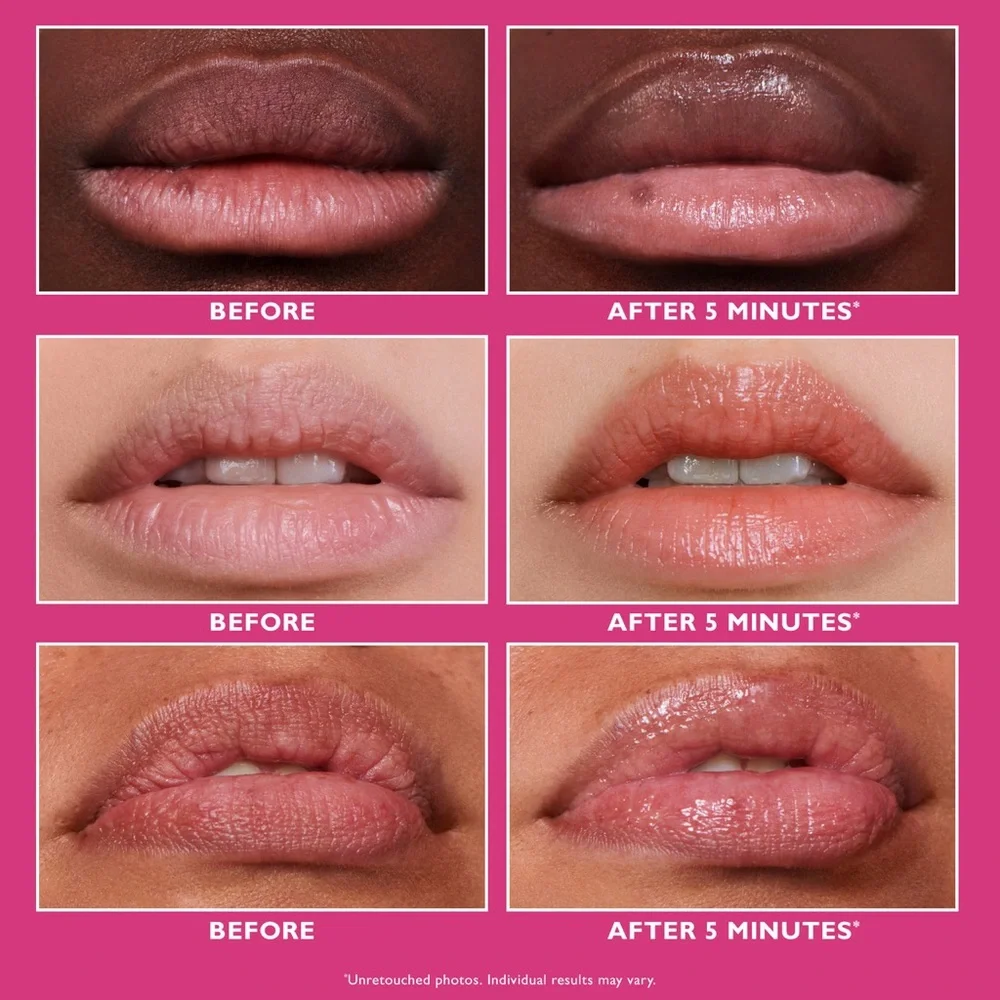 Peter Thomas Roth Instant FirmX Lip Filler